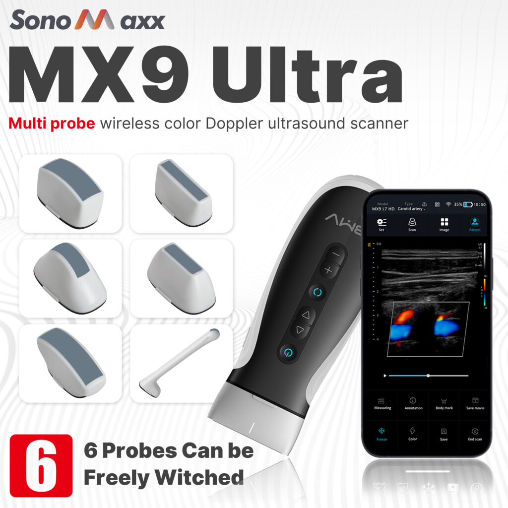 MX9 Ultra